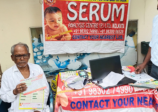 SERUM